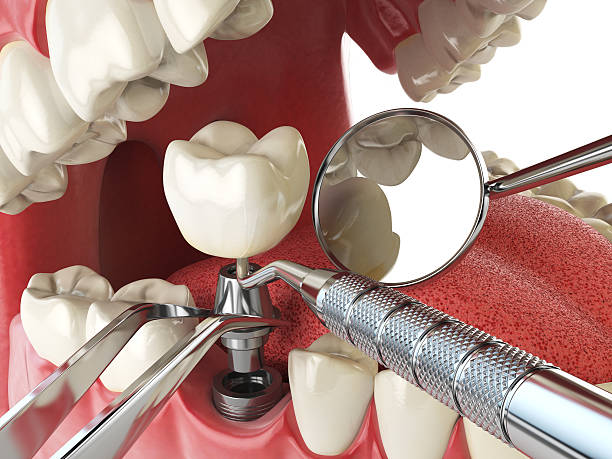 Best Tooth Infection Emergency Dentist  in West Mountain, UT